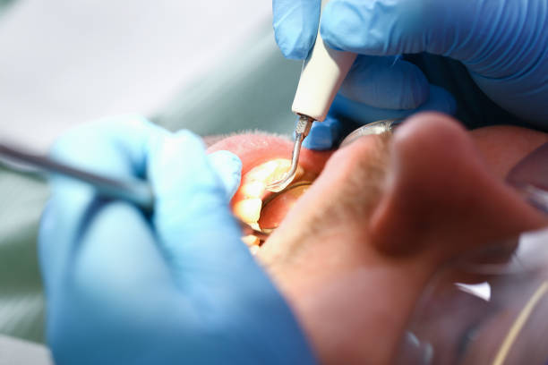Best Same-Day Emergency Dentist in Buda, TX